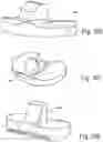 Fig. 10 - Method Of Designing Orthopedic Impants Using In Vivo