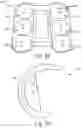 Fig. 16 - Method Of Designing Orthopedic Impants Using In Vivo