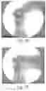 Fig. 23 - Method Of Designing Orthopedic Impants Using In Vivo