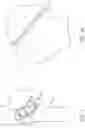 Fig. 02 - Patient specific stemless prosthesis anchor components
