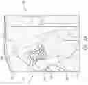 Fig. 05 - Patient specific stemless prosthesis anchor components
