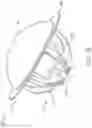 Fig. 06 - Patient specific stemless prosthesis anchor components