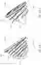 Fig. 13 - Patient specific stemless prosthesis anchor components