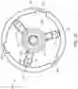 Fig. 15 - Patient specific stemless prosthesis anchor components