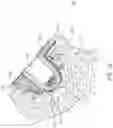 Fig. 22 - Patient specific stemless prosthesis anchor components