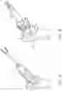 Fig. 27 - Patient specific stemless prosthesis anchor components