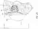 Fig. 33 - Patient specific stemless prosthesis anchor components