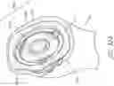 Fig. 45 - Patient specific stemless prosthesis anchor components