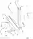 Fig. 07 - Perfected total shoulder prosthesis