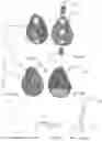 Fig. 15 - Perfected total shoulder prosthesis