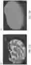 Fig. 05 - Artificial tessellated implants, and systems and methods of making and using same