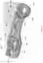 Fig. 25 - Expandable device