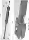 Fig. 34 - Expandable device