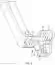Fig. 10 - Implant extractor