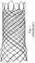Fig. 02 - Stent with anti-migration feature
