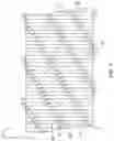 Fig. 11 - Stent with anti-migration feature