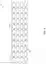 Fig. 12 - Stent with anti-migration feature