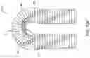 Fig. 16 - Stent with anti-migration feature
