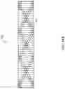 Fig. 20 - Stent with anti-migration feature