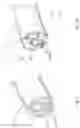 Fig. 11 - BALLOON ASSISTED ENDOLUMINAL PROSTHESIS DEPLOYMENT
