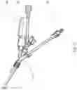 Fig. 14 - BALLOON ASSISTED ENDOLUMINAL PROSTHESIS DEPLOYMENT