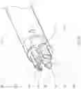 Fig. 15 - BALLOON ASSISTED ENDOLUMINAL PROSTHESIS DEPLOYMENT