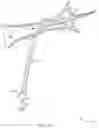 Fig. 06 - Rotatable stent delivery apparatus to cover access site