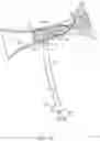 Fig. 10 - Rotatable stent delivery apparatus to cover access site