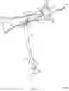 Fig. 11 - Rotatable stent delivery apparatus to cover access site