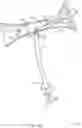 Fig. 12 - Rotatable stent delivery apparatus to cover access site