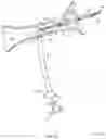 Fig. 14 - Rotatable stent delivery apparatus to cover access site