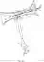 Fig. 15 - Rotatable stent delivery apparatus to cover access site