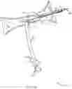 Fig. 17 - Rotatable stent delivery apparatus to cover access site