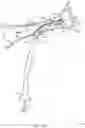 Fig. 21 - Rotatable stent delivery apparatus to cover access site