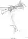 Fig. 24 - Rotatable stent delivery apparatus to cover access site