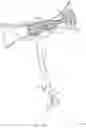 Fig. 25 - Rotatable stent delivery apparatus to cover access site