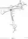 Fig. 27 - Rotatable stent delivery apparatus to cover access site