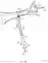 Fig. 28 - Rotatable stent delivery apparatus to cover access site