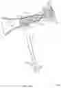 Fig. 32 - Rotatable stent delivery apparatus to cover access site