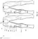Fig. 10 - Soft braces to prevent injury to a joint or body segment