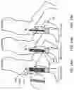 Fig. 15 - Soft braces to prevent injury to a joint or body segment