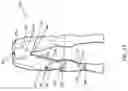 Fig. 24 - Soft braces to prevent injury to a joint or body segment