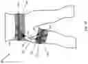 Fig. 31 - Soft braces to prevent injury to a joint or body segment