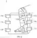 Fig. 03 - Orthosis manufacturing system, system for generating correction data for manufacturing orthosis, and orthosis manufacturing method