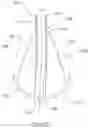 Fig. 14 - A DRAINABLE OSTOMY APPLIANCE