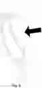 Fig. 06 - Menstrual cup