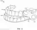 Fig. 10 - Methods and system for homogeneous dental appliance