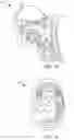 Fig. 11 - Methods and system for homogeneous dental appliance