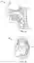 Fig. 12 - Methods and system for homogeneous dental appliance