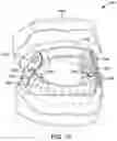 Fig. 14 - Methods and system for homogeneous dental appliance